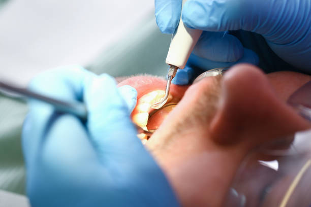 Best Emergency Dental Care for Broken or Chipped Teeth in Williamstown, KY